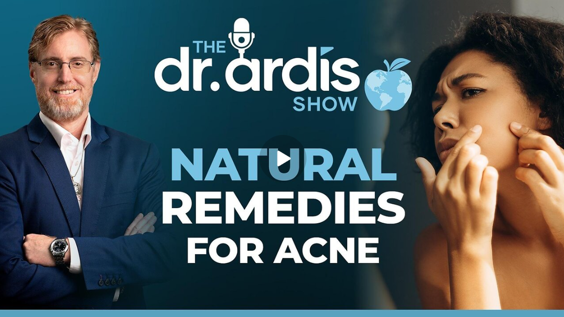 DA146- Natural Remedies for Acne - Dr. Ardis Show