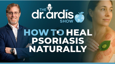 DA130-How to Heal Psoriasis Naturally - Dr. Ardis Show