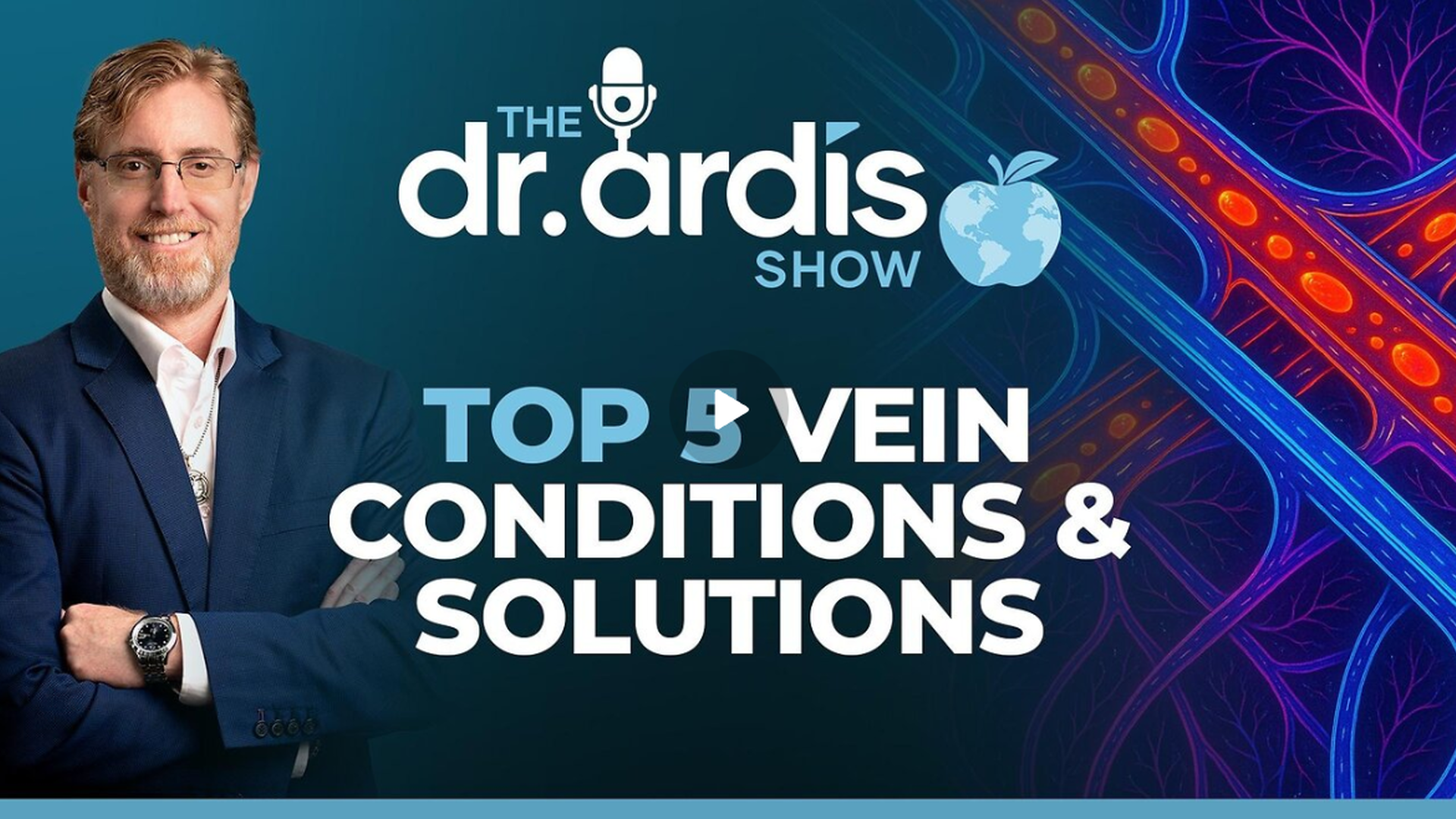DA167-Top 5 Vein Conditions & Solutions - Dr. Ardis Show
