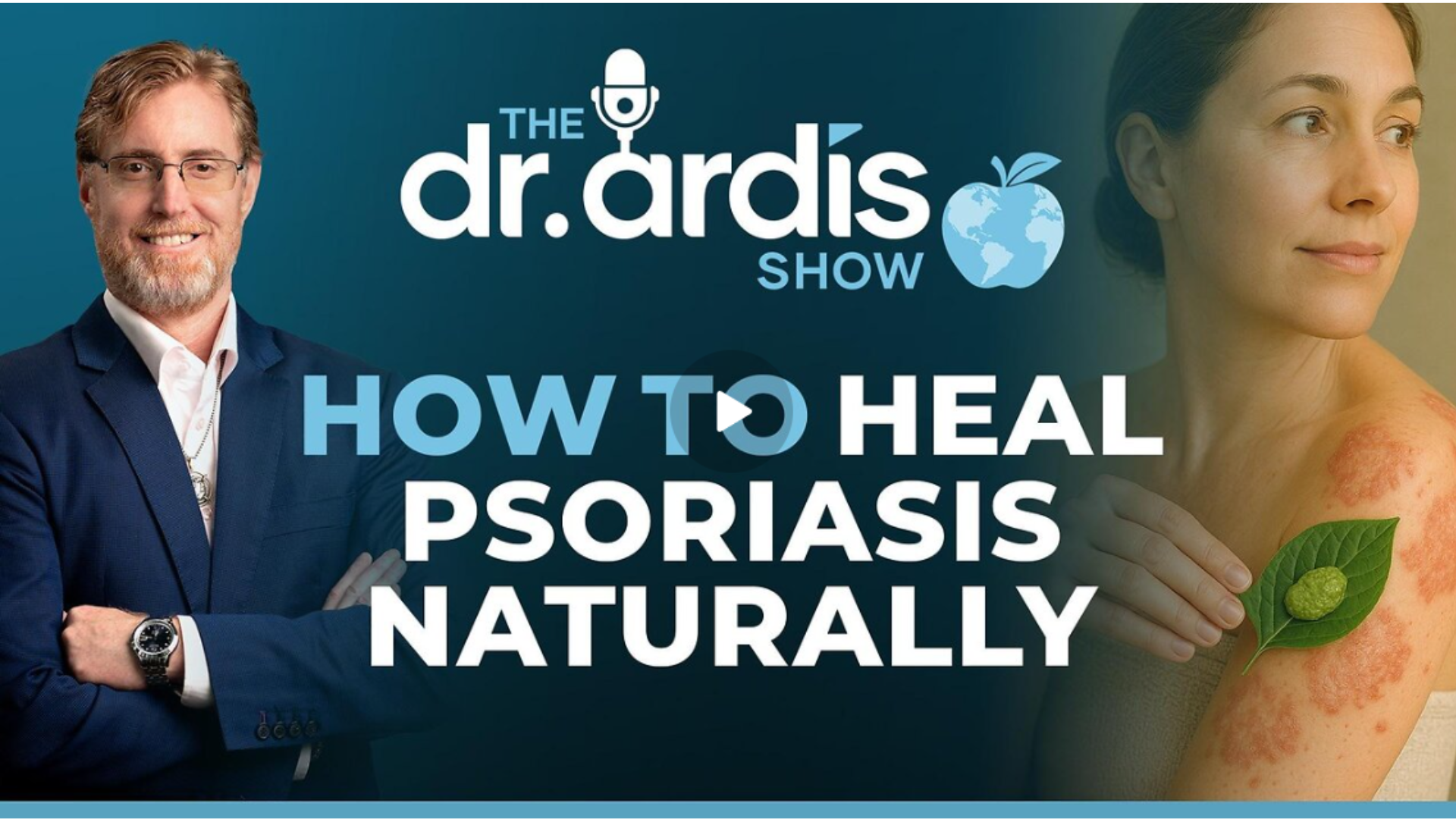 DA130-How to Heal Psoriasis Naturally - Dr. Ardis Show